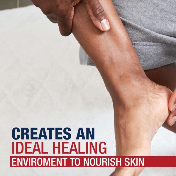 Aquaphor Healing Ointment, Advanced Therapy Skin Protectant, Multi-Purpose Healing Ointment and Body Moisturizer, For Dry, Cracked Skin, Minor Cuts and Burns, 14 Oz Jar - Image 5